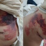 Cirurgião plástico mutila mais uma vítima e a matém em cárcere privado em sua casa