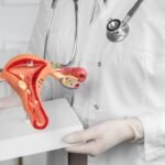 Exame papanicolau vai ser substituído pelo teste molecular de DNA-HPV: entenda mudança