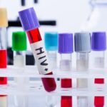 Brasil reduz transmissão do HIV vertical e pede certificado da Opas