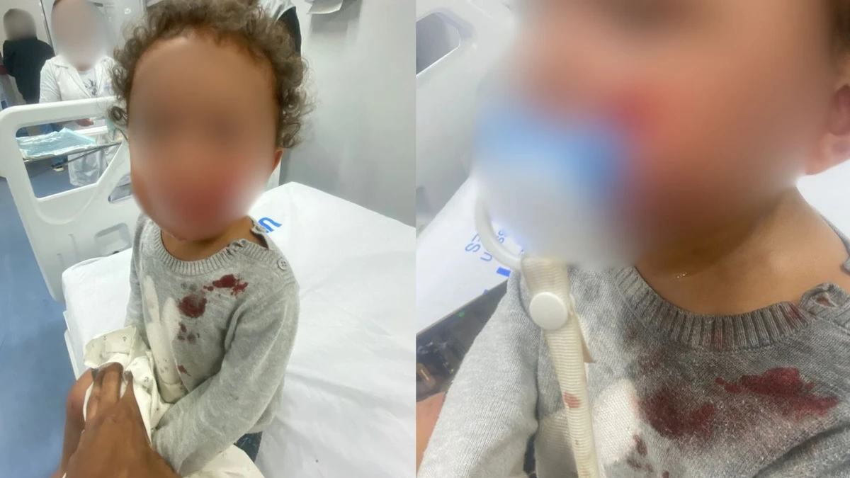 Bebê de um ano é atacado por pitbull em Marataízes (ES)