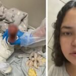 Bebê que teve pé queimado em hospital no ES vai ter que fazer enxerto