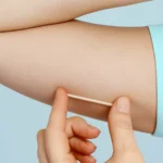 Prefeitura de Araruama (RJ) passa a oferecer implante contraceptivo gratuito na rede municipal de saúde