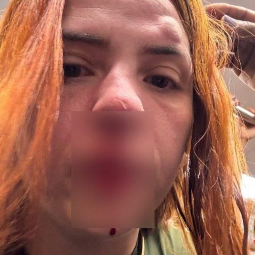Mulher tem nariz quebrado ao levar socos dentro de vagão feminino do MetrôRio