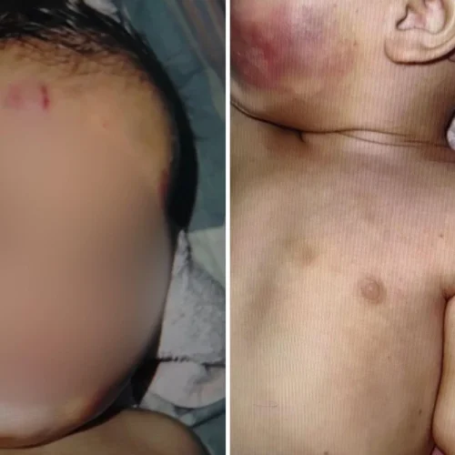 Mãe e padrasto são presos em Vila Velha (ES) após bebê de 7 meses ser encontrada com marcas de mordidas