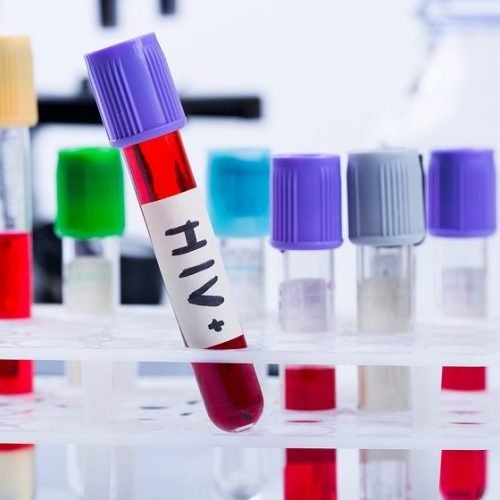 Brasil reduz transmissão do HIV vertical e pede certificado da Opas