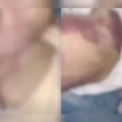 Criança de 2 meses é encontrada morta com diversas marcas pelo corpo